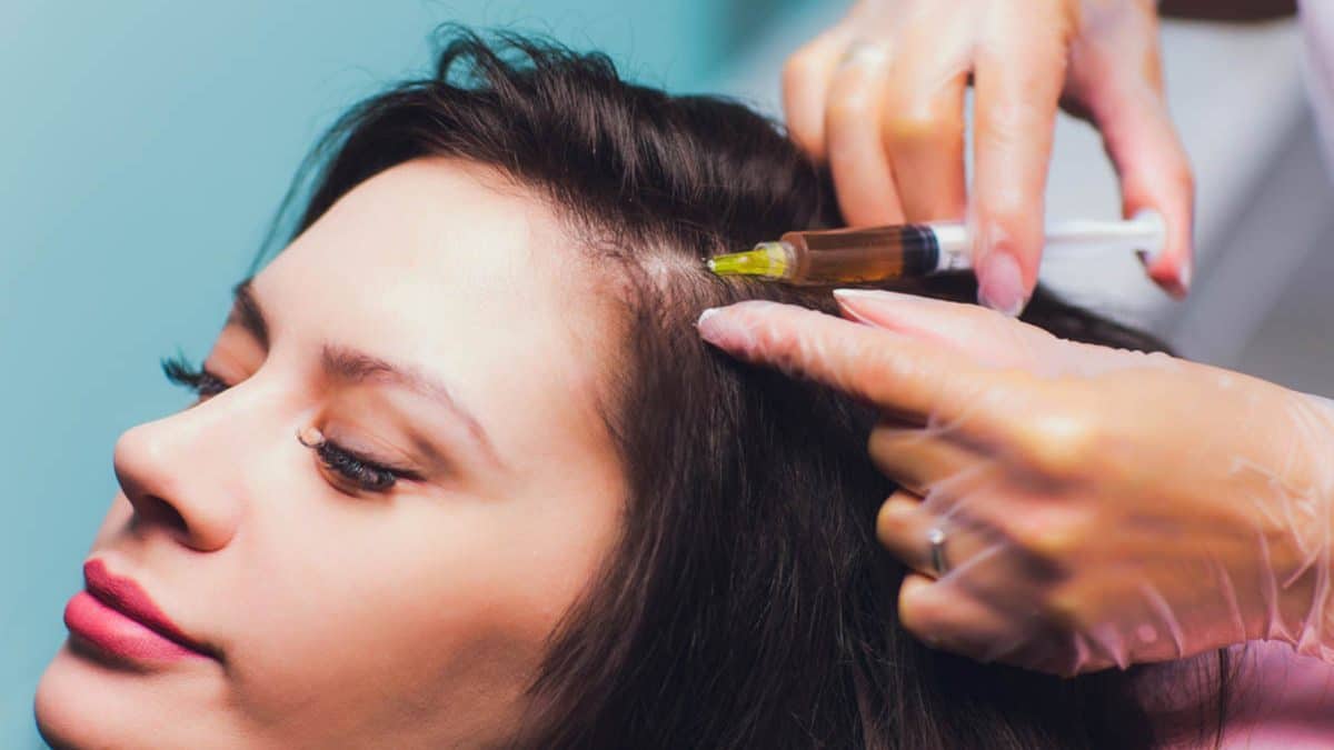 PRP Injection in Dubai Best Hair Loss & Skin Rejuvenation Treatment