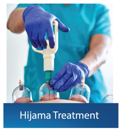 Hijama-Treatment
