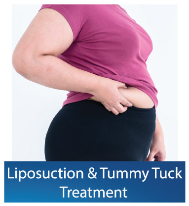 Liposuction-Tummy-Tuck