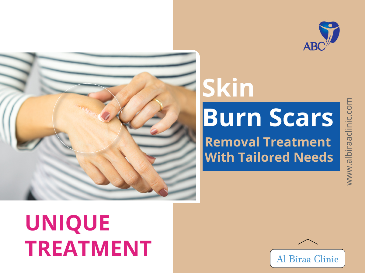 Skin Burn Scar Removal
