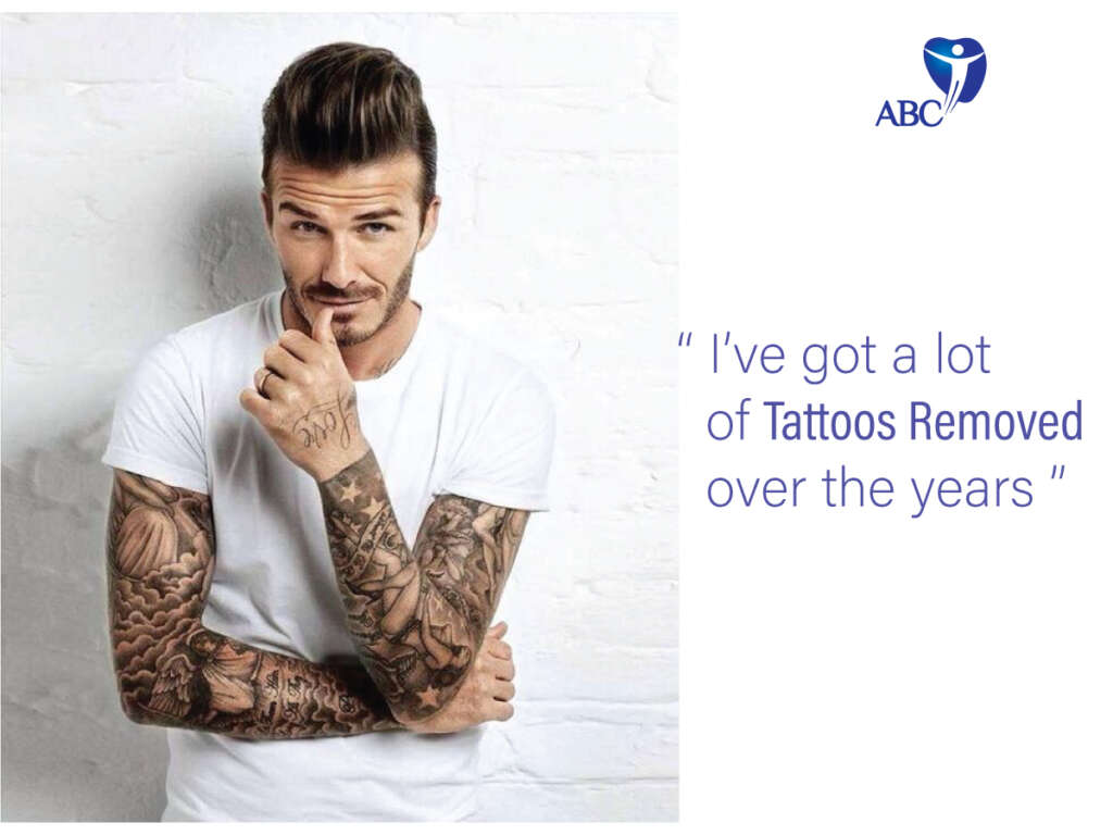Aggregate 92+ about khloe kardashian tattoos removed best -  .vn