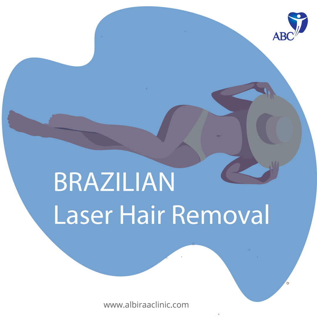 Laser Hair Removal A Permanent Hair Removal Solution