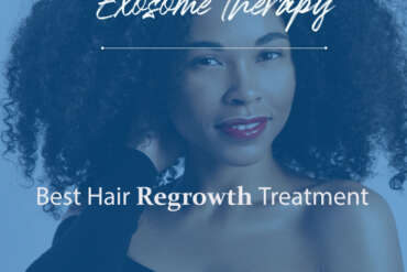 The Use of Exosomes in Clinical Practice for Hair Loss Prevention/Restoration