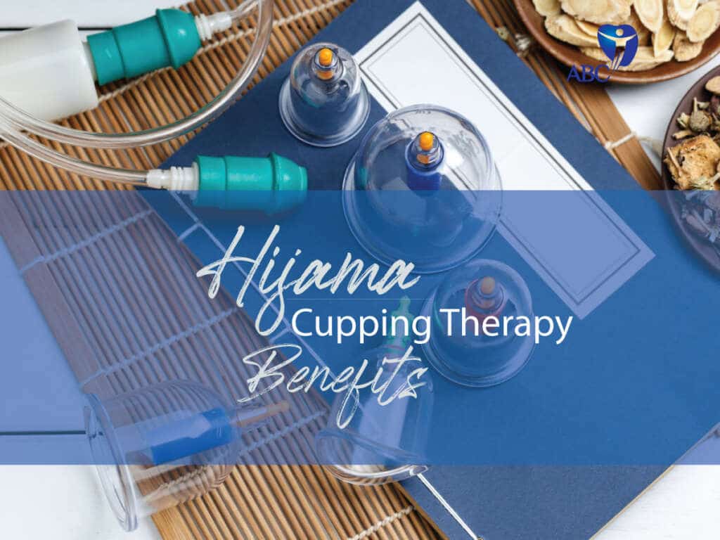 The Key Benefits of Cupping Therapy