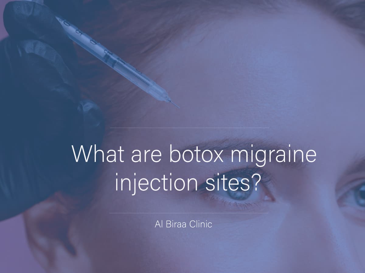 Botox-Injection-Migraines-Sites