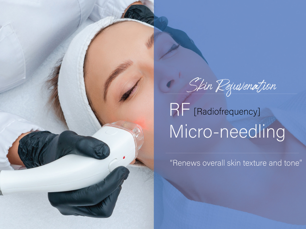 RF-Microneedling-Al-Biraa-Clinic