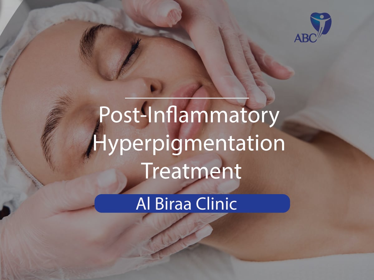 Post-Inflamatory-hyperpigmentation-treatment