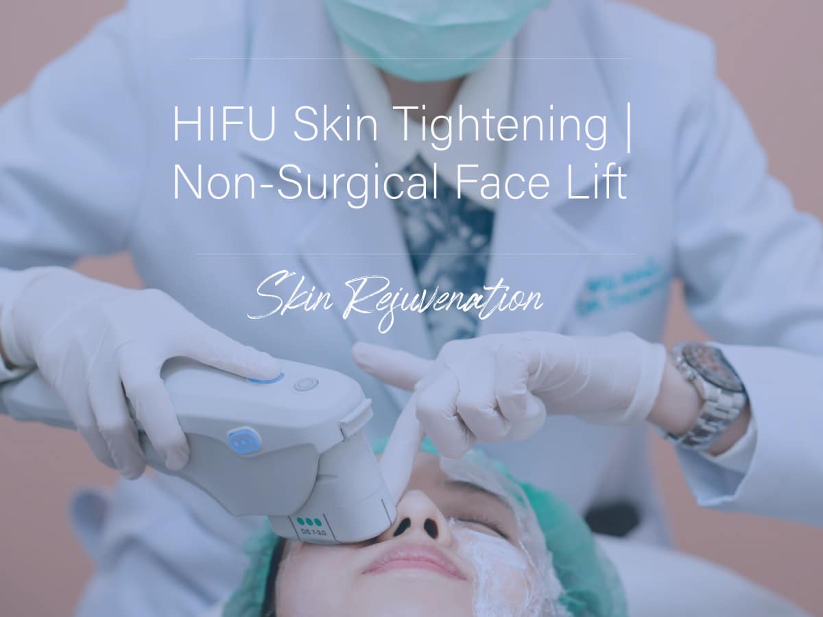 Hifu-skin-tightening