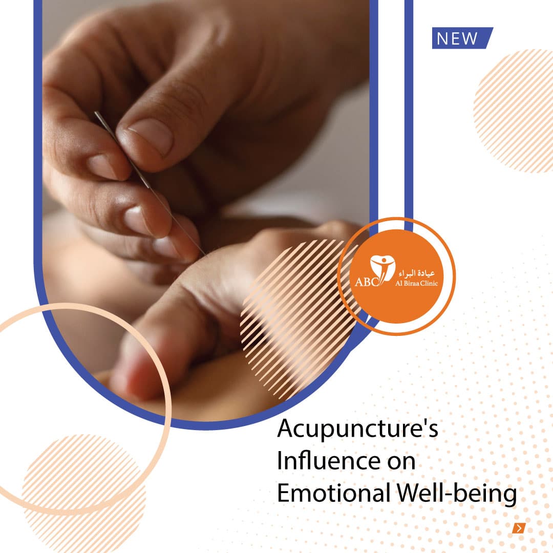 Acupuncture-Emotional-wellbeings