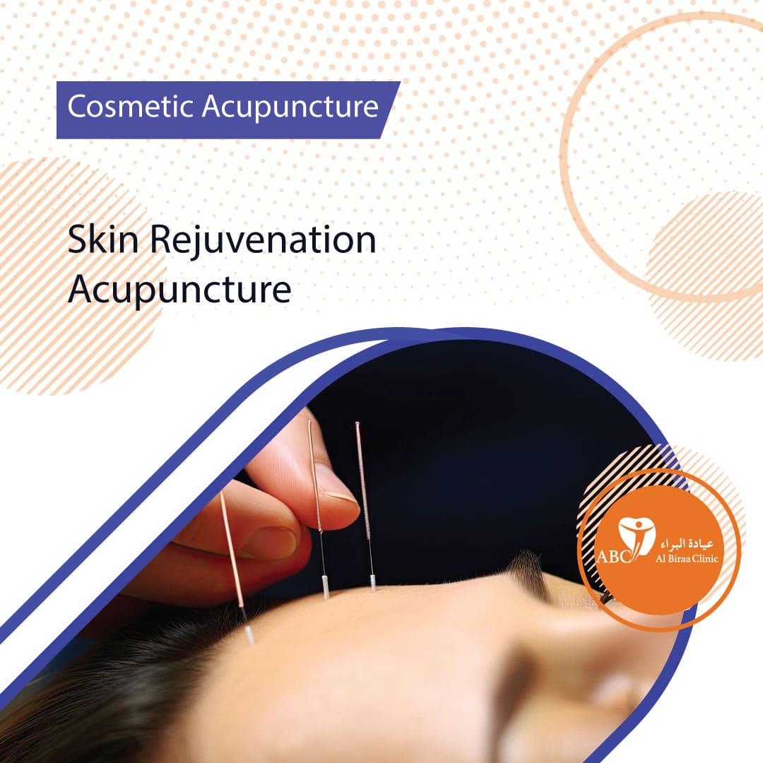 Skin-Rejuvenation-Acupuncture
