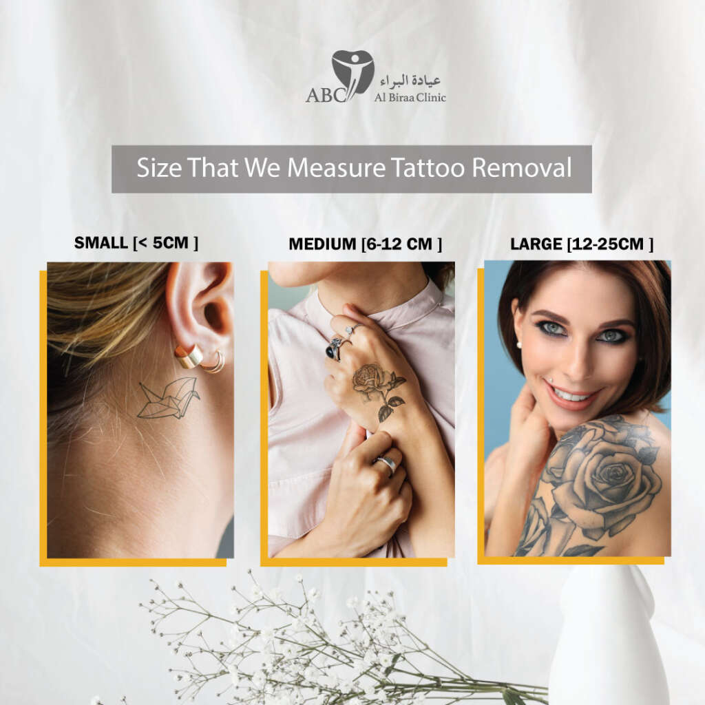 Size That We Measure Tattoo Removal- for Price