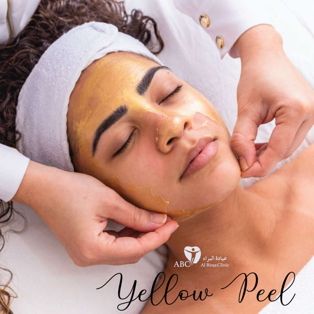 Best Yellow Peel Treatment in Dubai