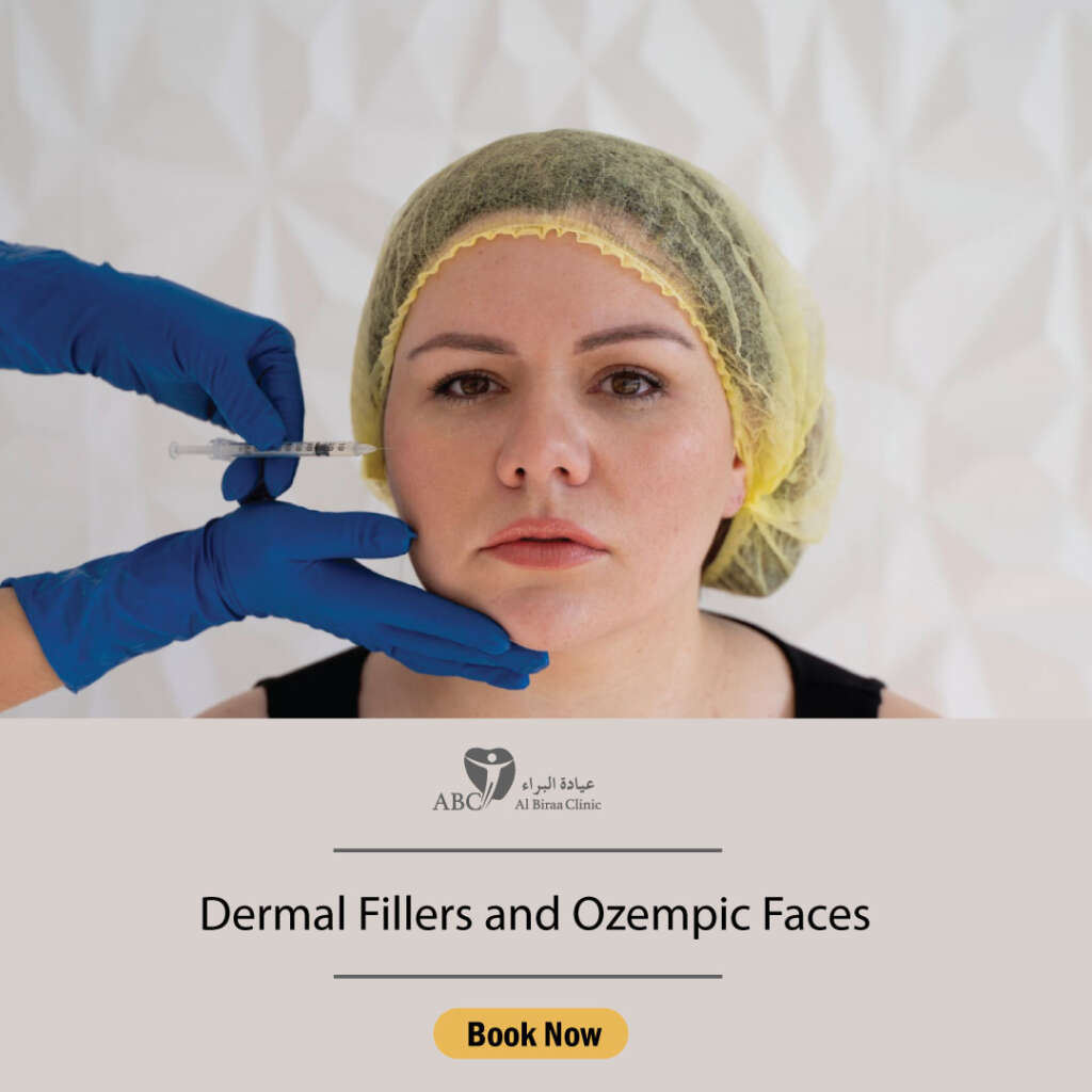 Dermal Fillers and Ozempic Faces
