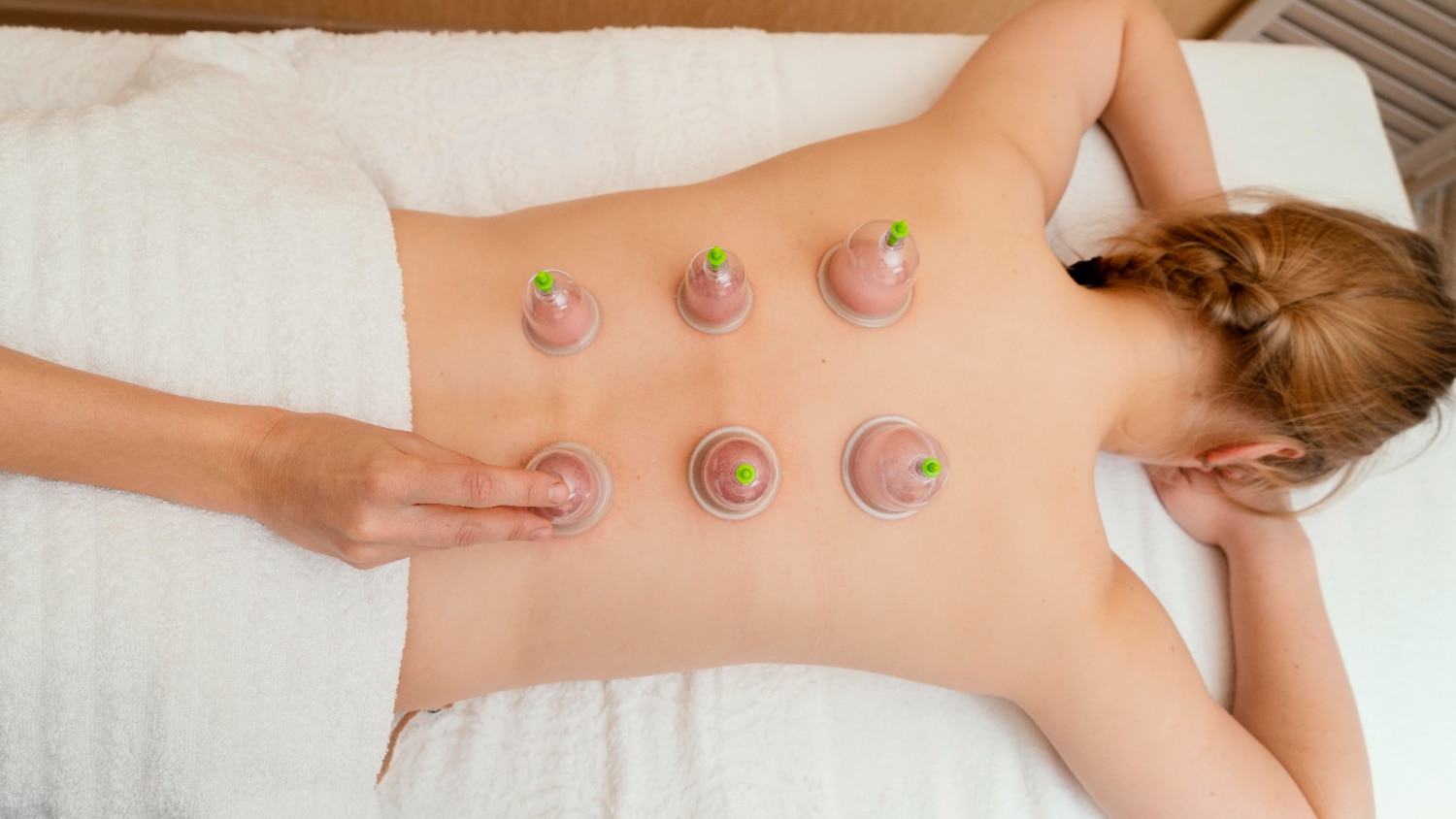 Natural Migraine Relief via Hijama Cupping Therapy in Dubai