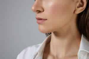 Acanthosis Nigricans Treatment Dubai