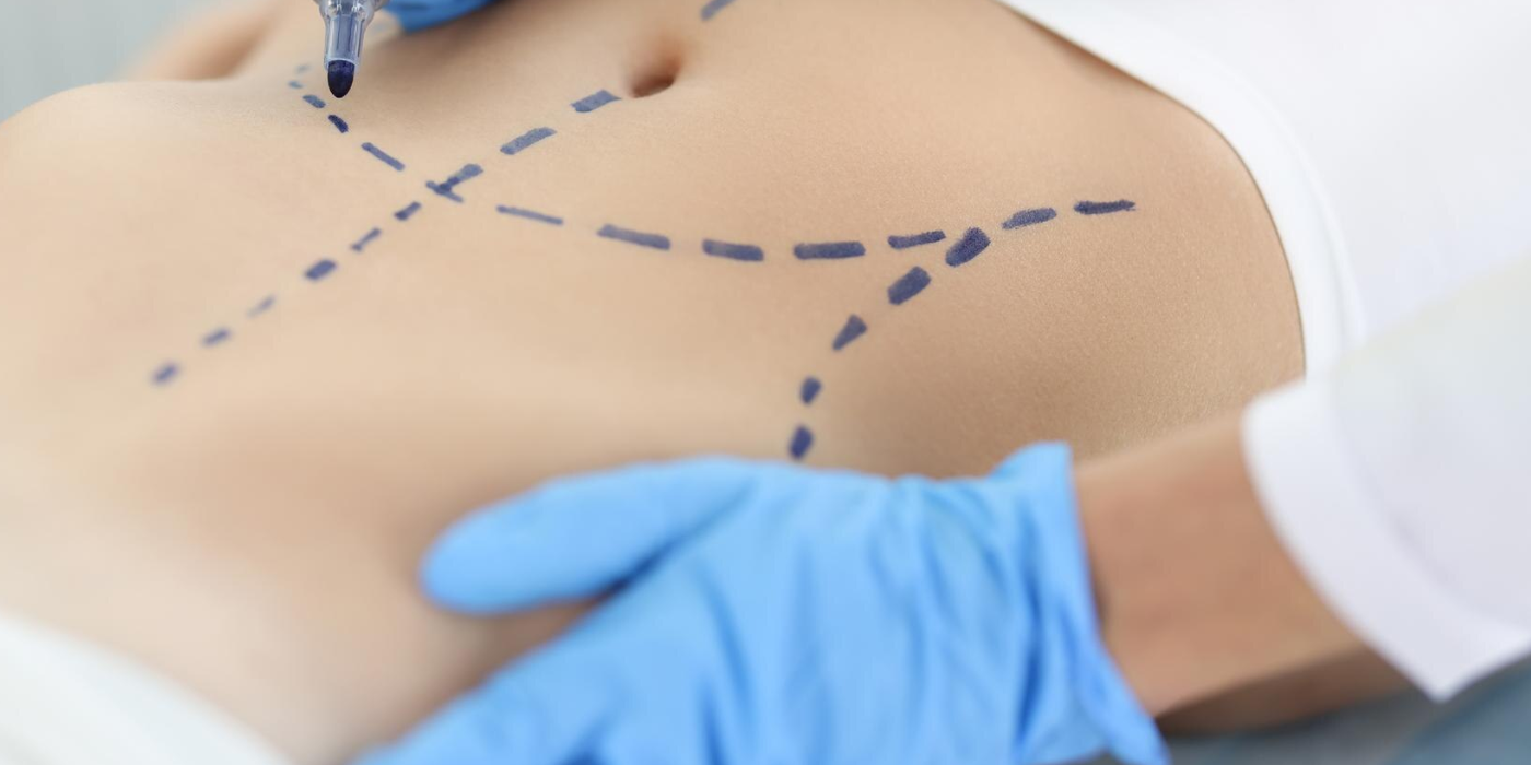 Plastic Surgery in Dubai
