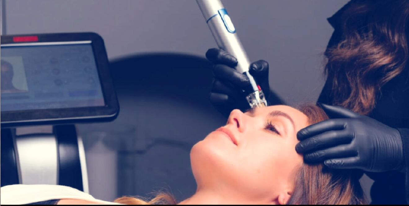 Lutronic Genius RF Microneedling- Face