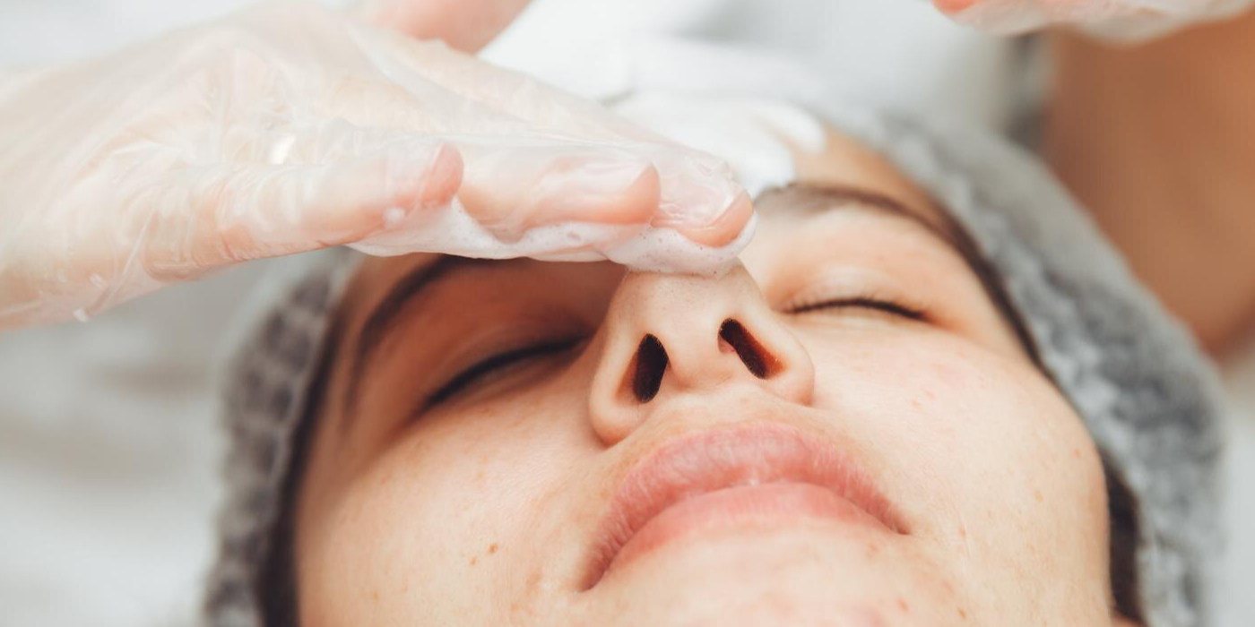 Whiteheads & Blackhead Removal Treatment Dubai