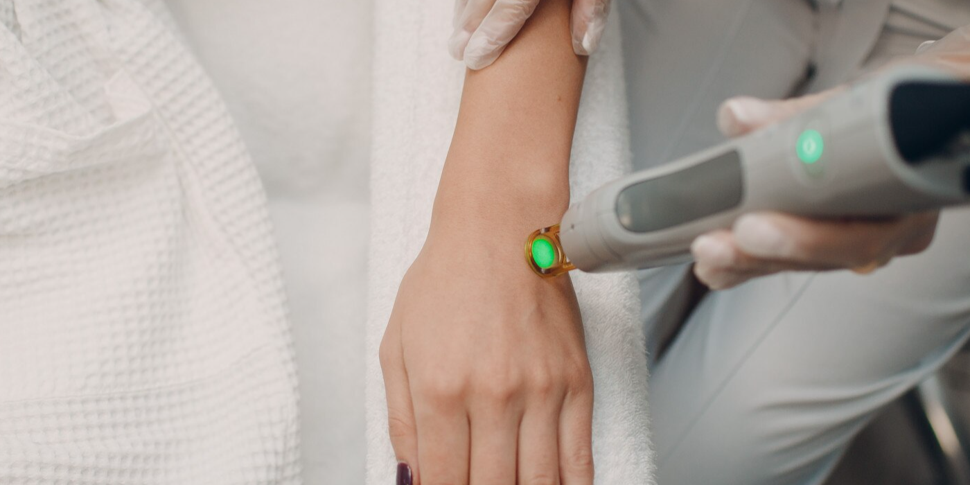 Laser Hand Rejuvenation