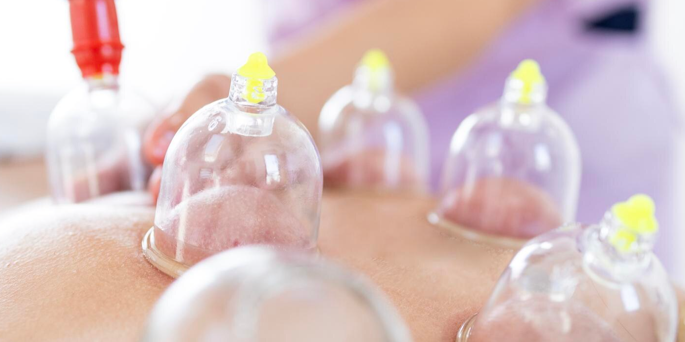 Back Pain Cupping Therapy Dubai