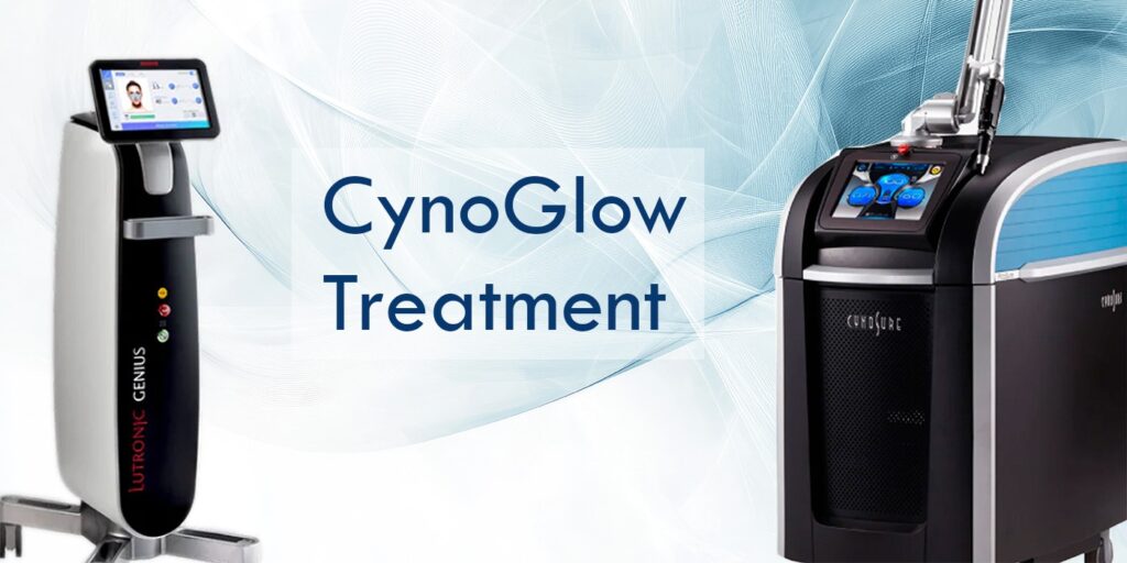CynoGlow Treatment | Al Biraa Clinic