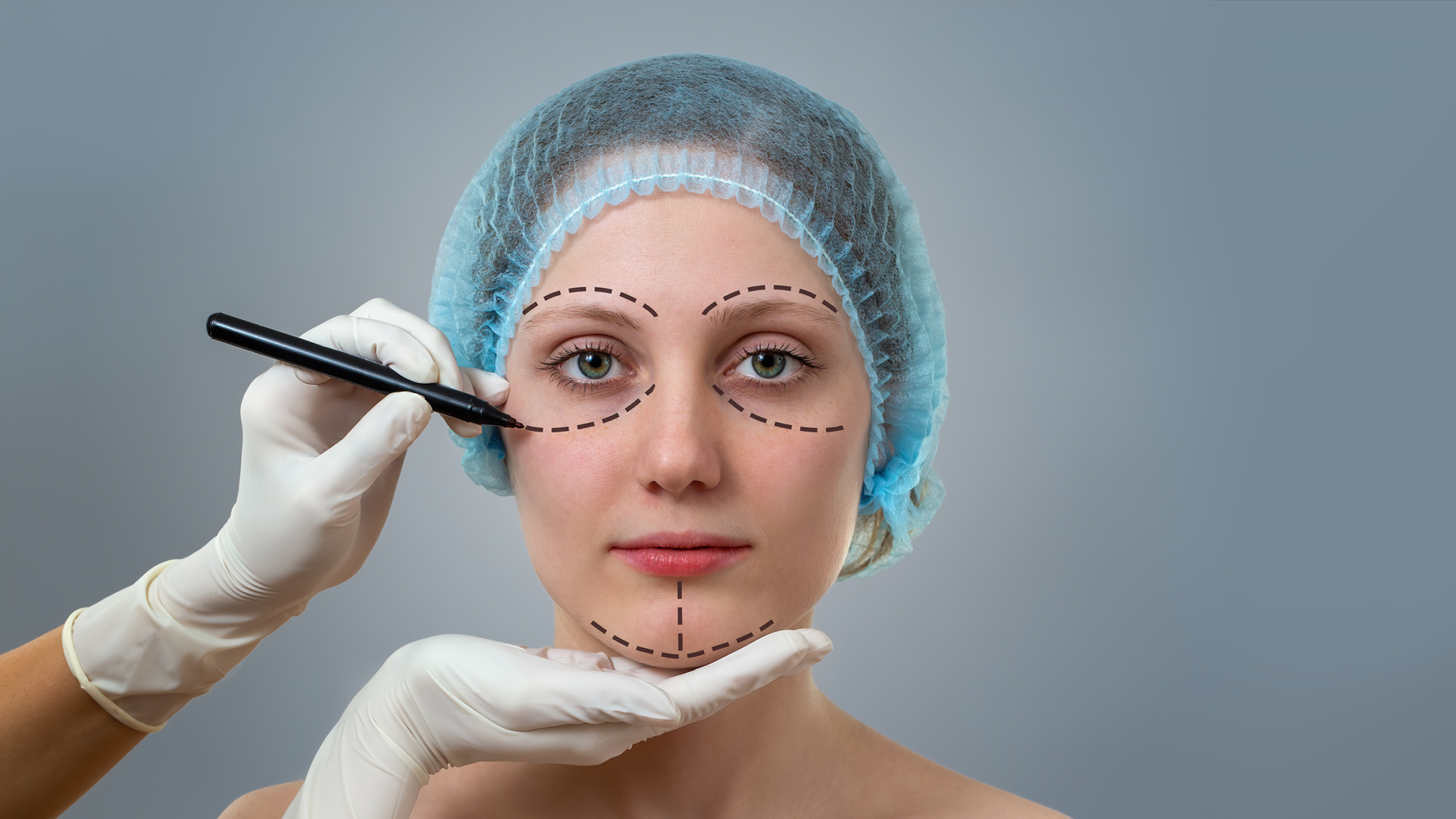 PDL PLLA PCL Face Lift Treatment | Advanced Thread Lift Dubai | Al ...