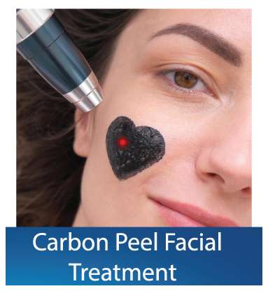 Best Carbon Peel Facial Treatment in Dubai