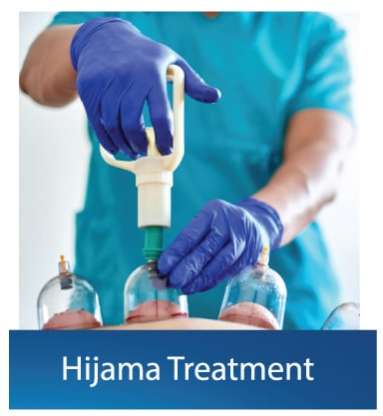 Hijama-Treatment Dubai