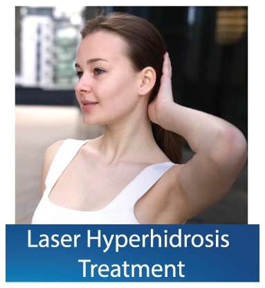 Laser-Hyperhidrosis-treatment in Dubai
