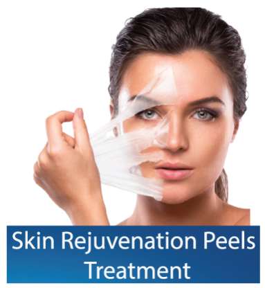 Best skin-rejuvenation-peel-in Dubai