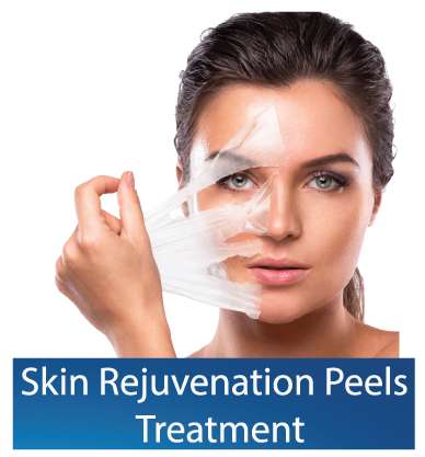 Best skin-rejuvenation-peel-in Dubai