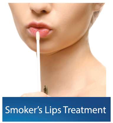 Smokers-Lips Treatment Clinic in Dubai